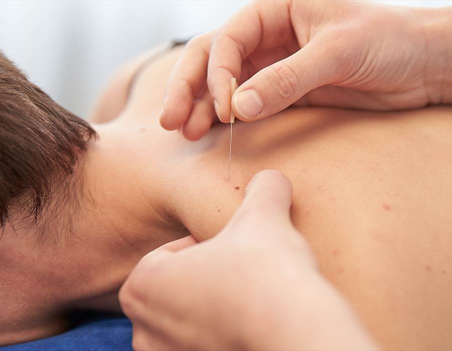 Dry Needling in fisioterapia e riabilitazione