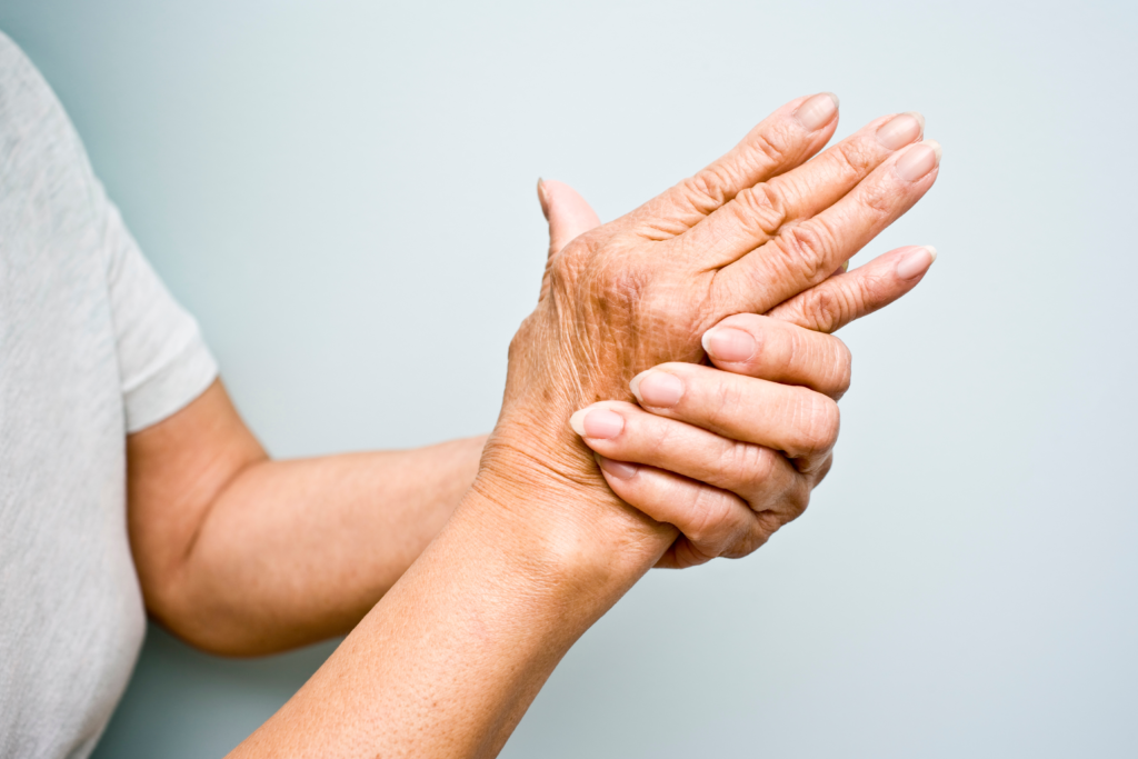 dolore alle mani dovuto a deformazione da artrite reumatoide affrontabile con approccio multidisciplinare