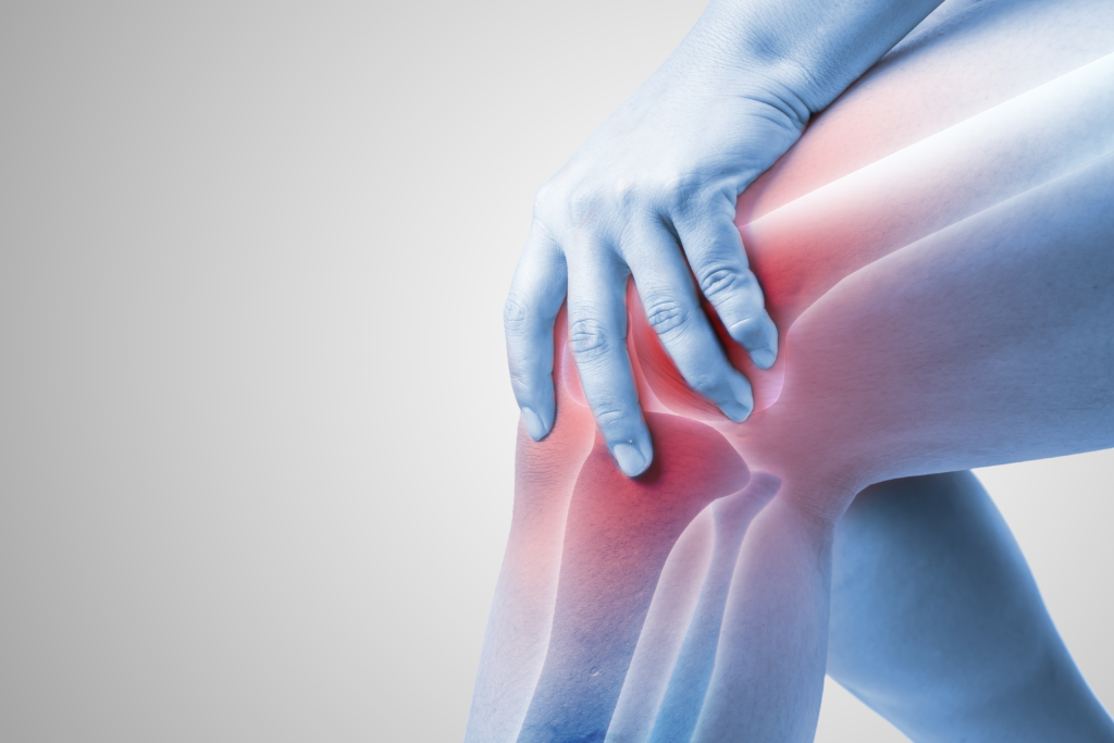la gonartrosi è un'artrosi del ginocchio che genera dolore articolare