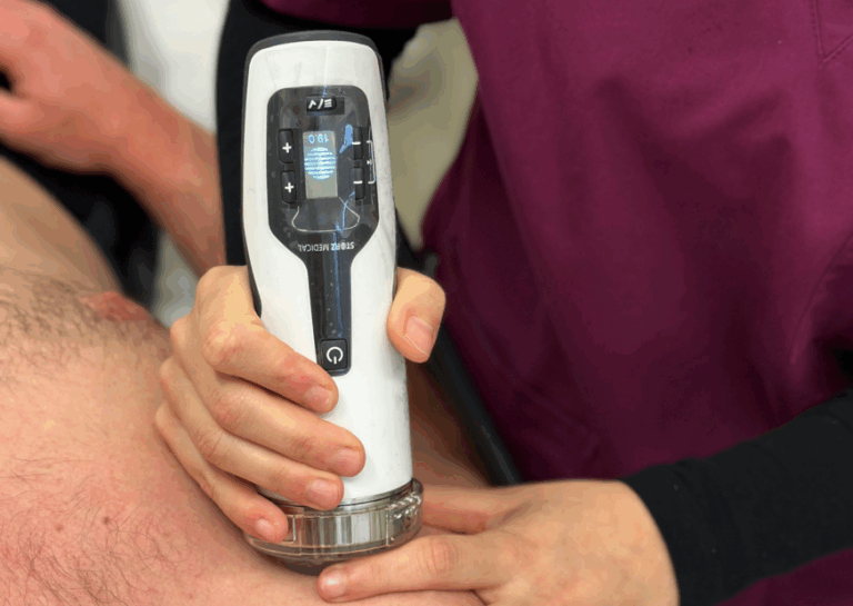 Trattamento con onde d’urto focali Storz Medical presso la fisioclinic del Centro Colombo Genova: applicazione terapeutica per tendiniti, fascite plantare e calcificazioni, eseguita da fisioterapista specializzato